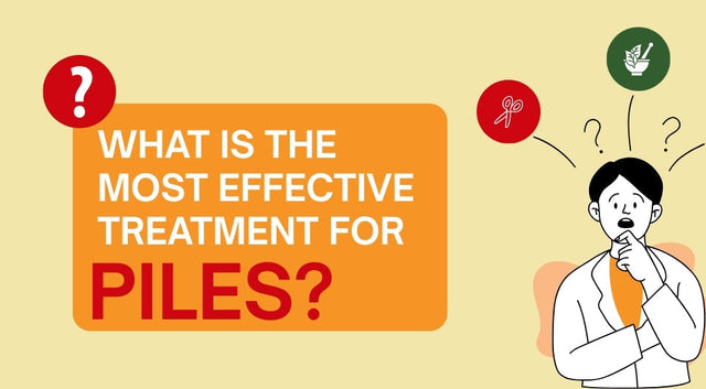 Most Effective Treatment for Piles